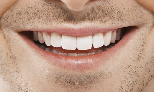 tooth abscess, Silver Fern Dental